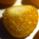 kidney stones formed by cystine