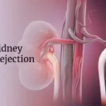 rapamycin is used to prevent kidney transplant rejections